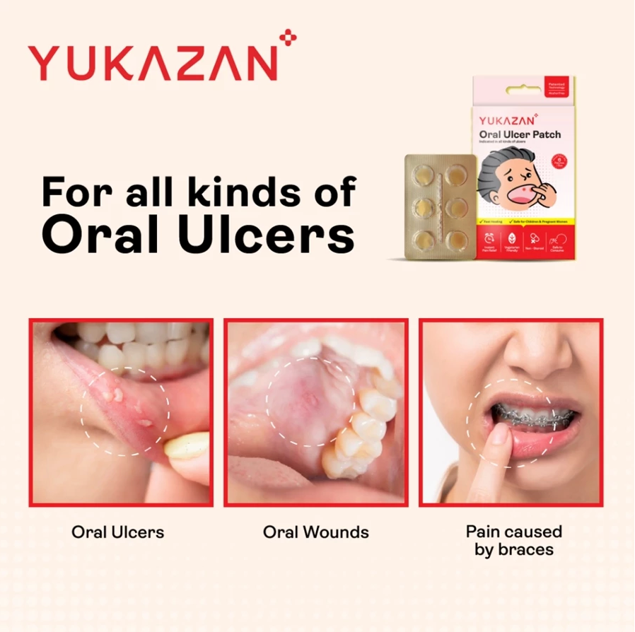 Yukazan Oral Ulcer Patch (6 pieces)