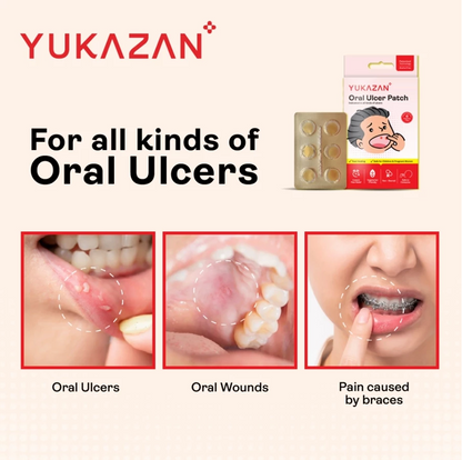 Yukazan Oral Ulcer Patch (6 pieces)